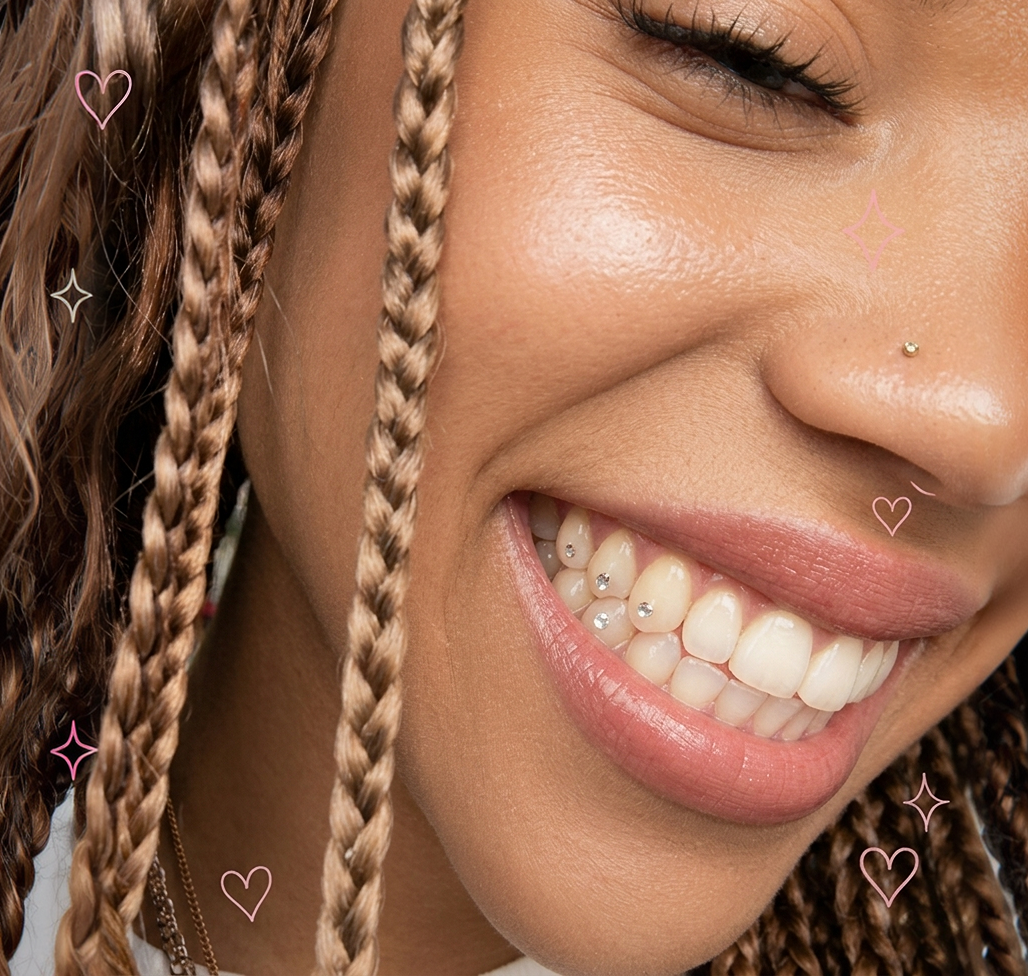 Smile with a tooth gem — customer result 8