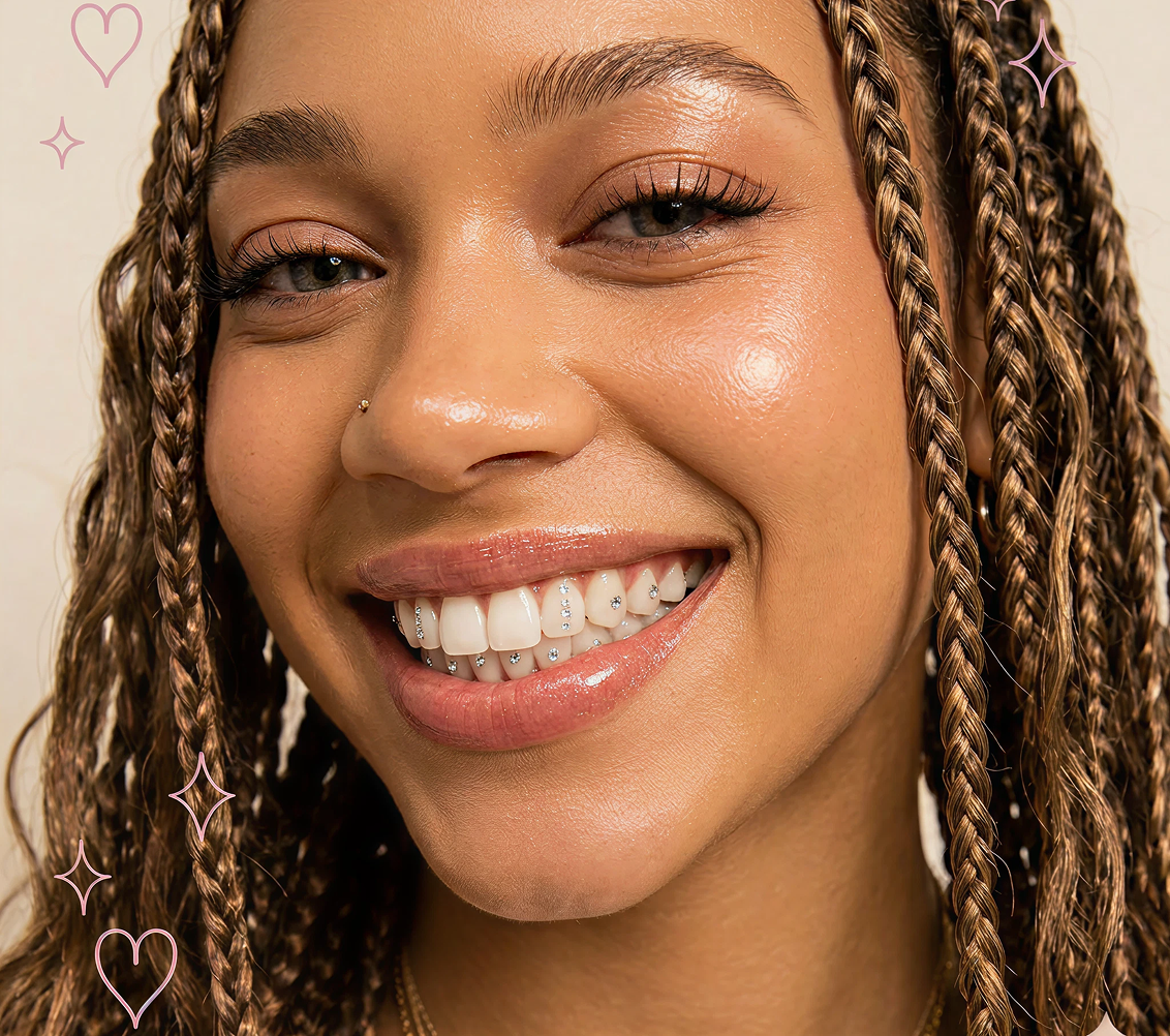 Smile with a tooth gem — customer result 9