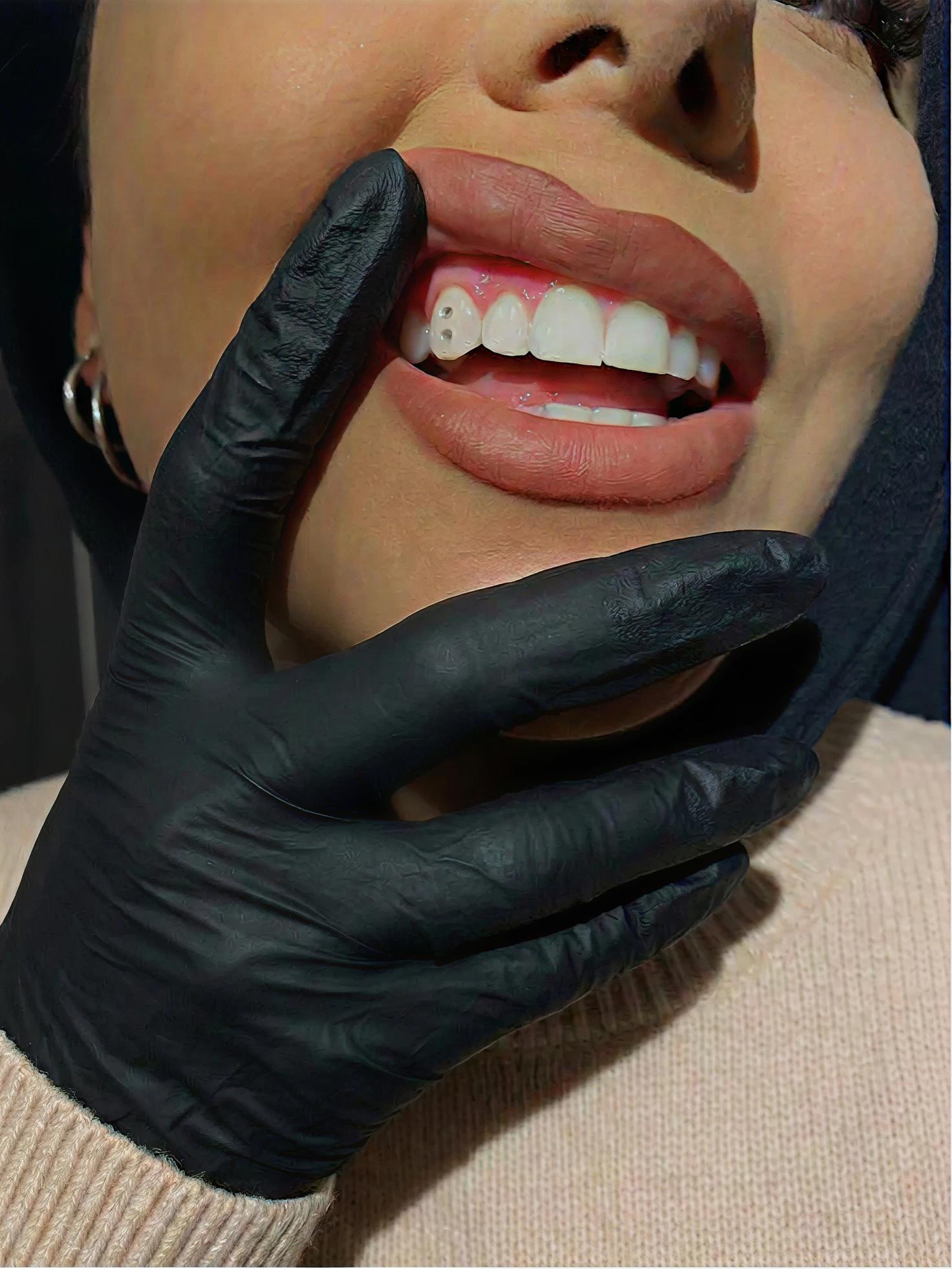 Enjoy your sparkling smile.